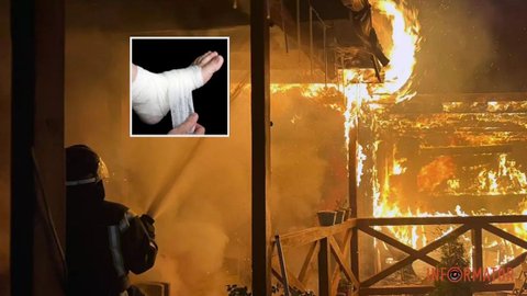 В Днепровском районе горел дом: пострадал 57-летний мужчина