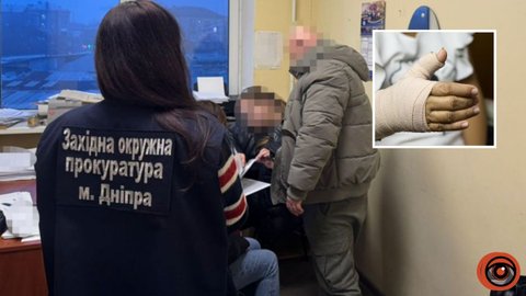 У Дніпрі судитимуть лікаря, який прооперував 8-річній дитині здорову руку замість зламаної