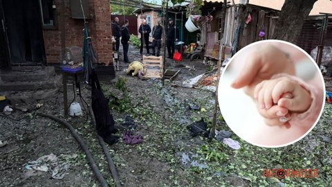 В Кривом Роге из-за дроновой атаки пострадала 9-месячная девочка: ребенка успешно прооперировали и будут лечить в Днепре