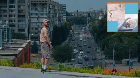 Брудні руки, вода та домашні улюбленці: у Дніпропетровській області попередили про ризик зараження гельмінтами влітку