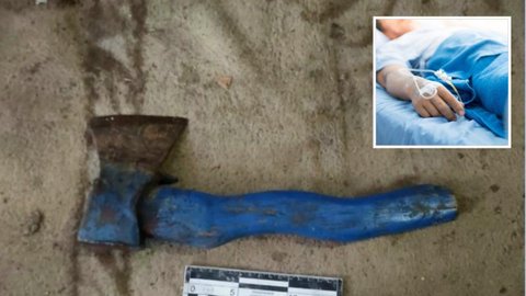 У Кам'янському жінка кілька разів вдарила співмешканця сокирою по голові: постраждалого госпіталізували