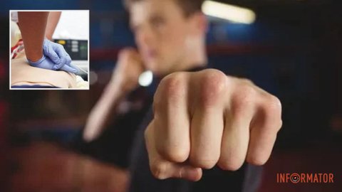 Бил руками и ногами по голове: в Кривом Роге прохожий тяжело травмировал 51-летнего мужчину