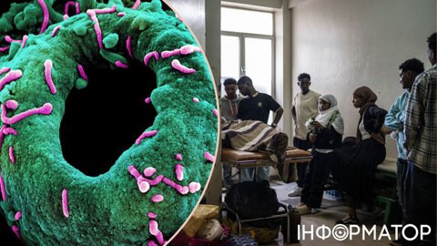 В Эфиопии зафиксировали случай вируса Марбург - это хуже COVID и вообще любой известной болезни