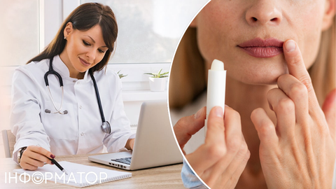 Реальний спосіб назавжди вилікувати герпес на губах – медики розкрили правду