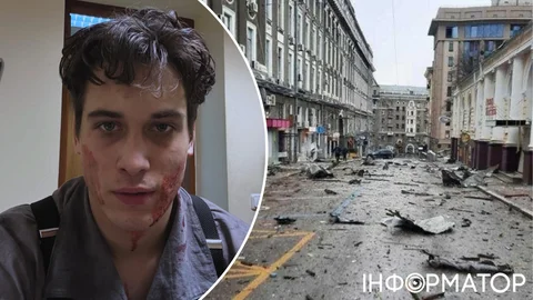 По знімальній групі фільму з Іваном Довженко прилетів КАБ - є постраждалі