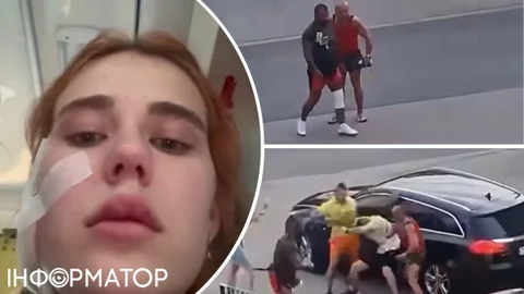 В Польше трое поляков жестоко избили украинскую пару – причиной стал их акцент (видео)