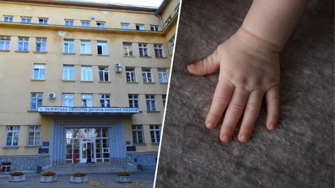 У Львові однорічна дівчинка ледь не загинула, вдихнувши арахіс - лікарі провели надскладну операцію