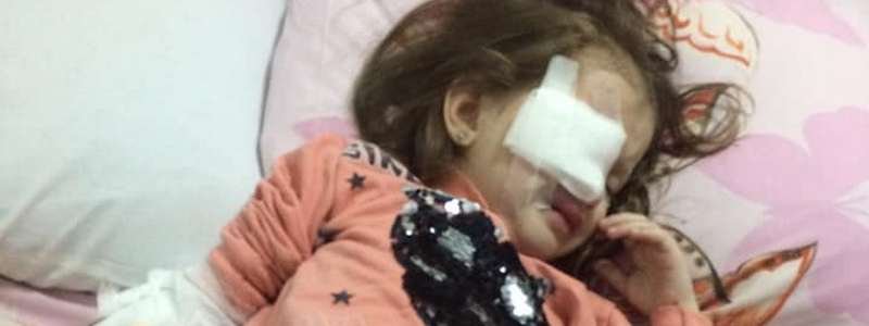 В Днепре в садике 3-летняя девочка чуть не выколола глаз своей подружке: новые подробности