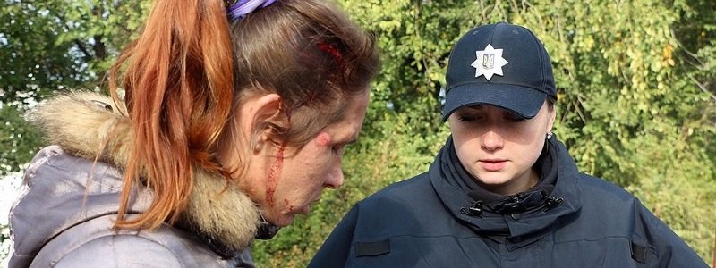 В Днепре водитель легковушки сбил женщину на велосипеде (ФОТО, ВИДЕО)