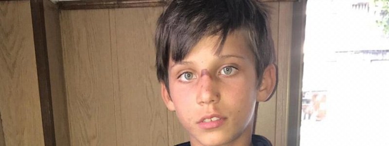 В Днепре ищут 12-летнего мальчика, который сбежал из больницы