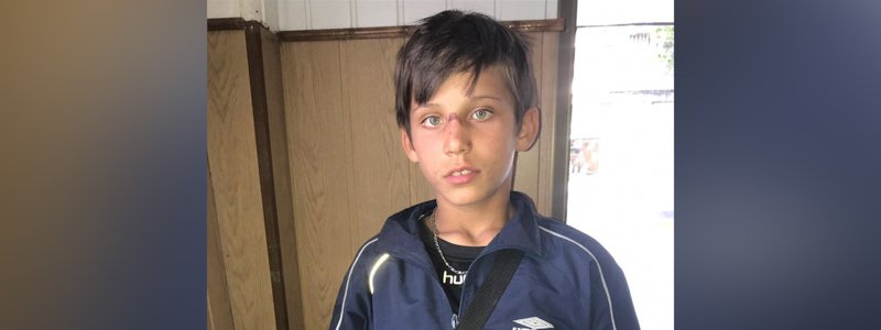 Сбежавшего из детской больницы 12-летнего мальчика нашли в 200 километрах от Днепра
