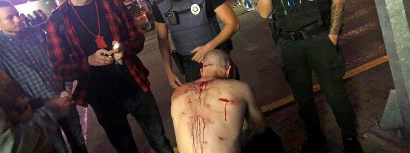 В Днепре возле ТЦ "МОСТ-Сити" мужчину порезали ножом