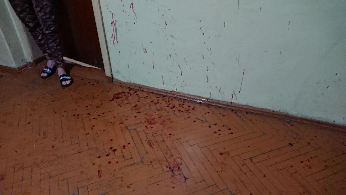 В общежитии Днепра пьяный студент-иностранец в крови бросался с ножом на людей