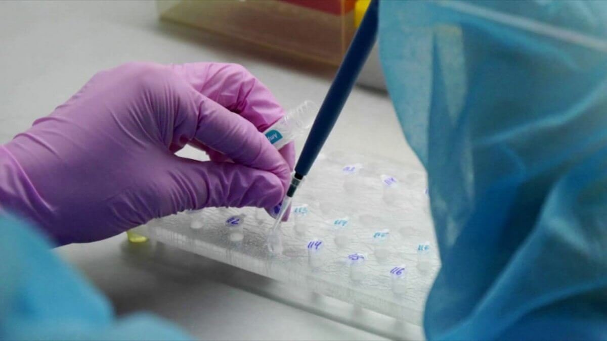 В Днепр направят немецкие тест-системы для обнаружения коронавируса
