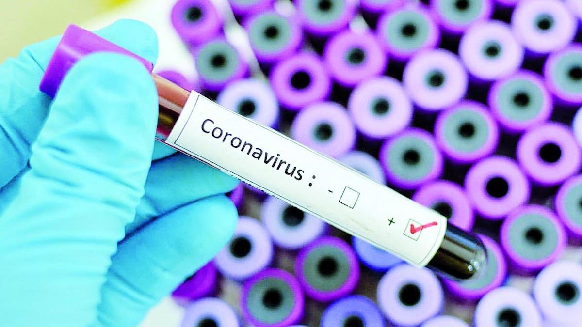 В Украине подтвердились еще 2 случая коронавируса: новые данные