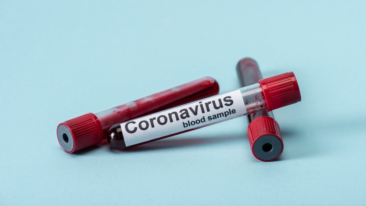 В Украине зафиксировали 1319 случаев коронавирусной болезни COVID-19