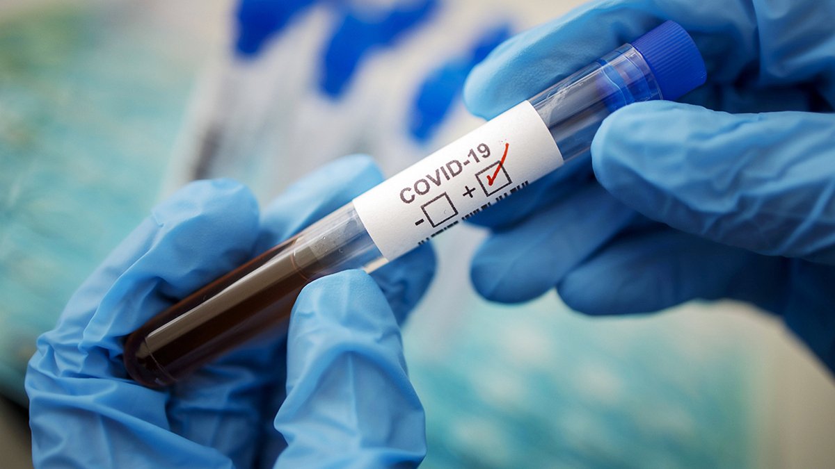 Актуальная статистика в Днепре: зафиксирован новый случай заболевания коронавирусом