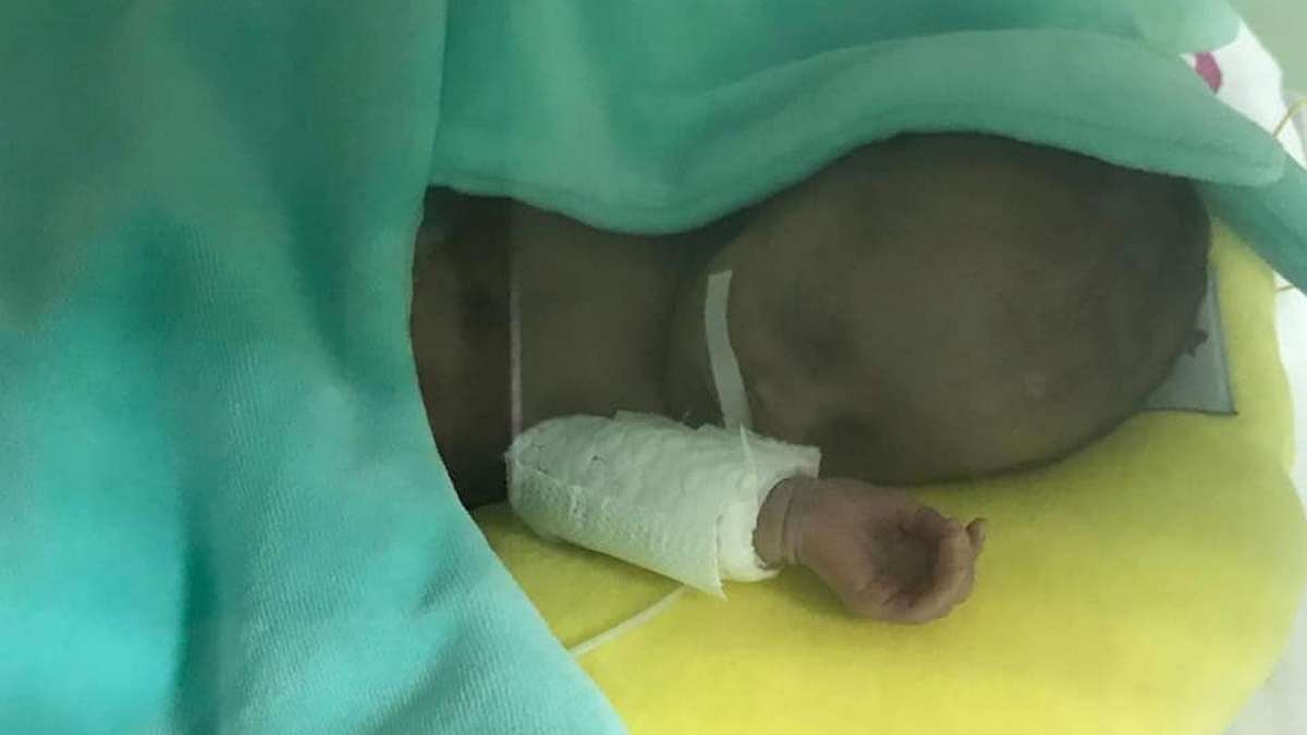 В Днепре врачи больницы Мечникова выходили малыша весом 1,2 кг