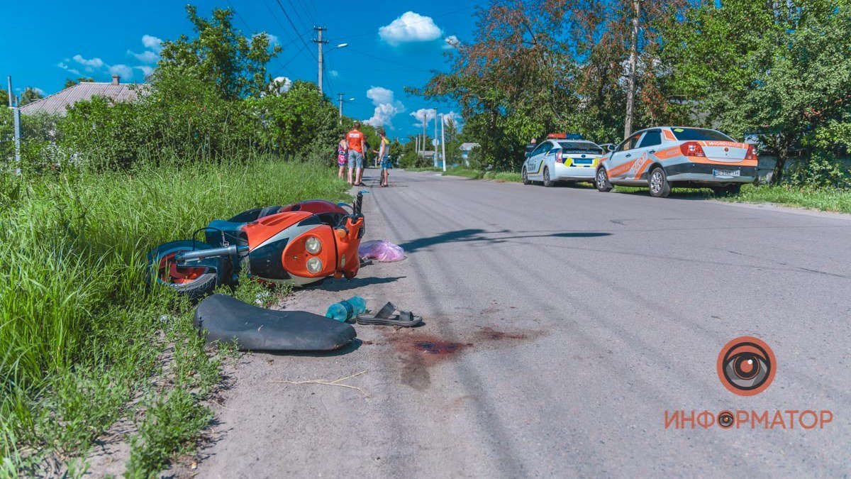 В Днепре на Гуртовой водитель мотороллера въехал в яму и упал: мужчина получил травмы