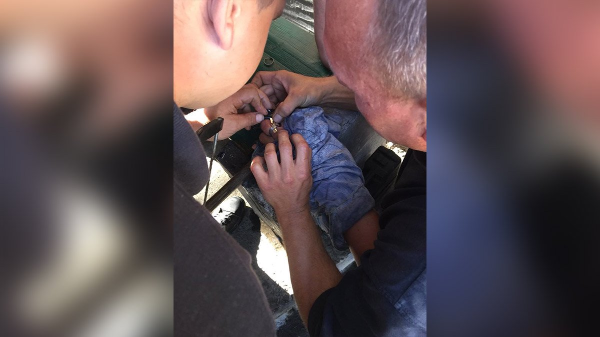 В Днепре у 15-летнего парня застряло кольцо на пальце: пришлось обращаться к спасателям