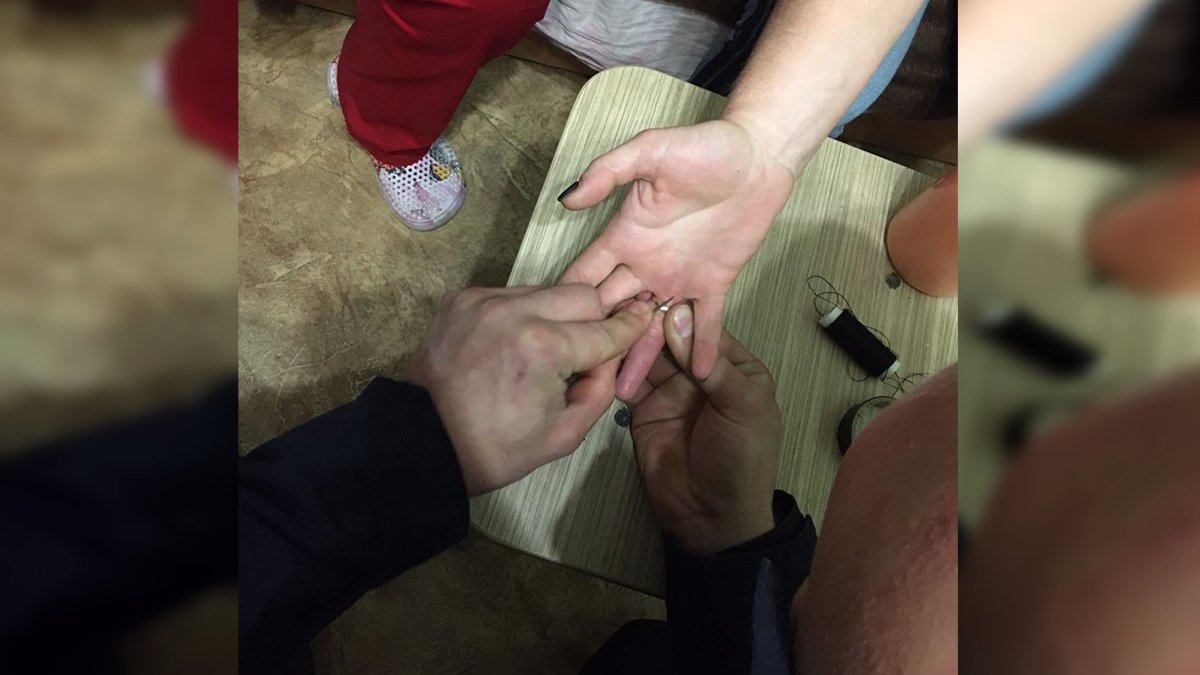 В Днепре спасатели приехали на помощь женщине, которая не могла снять кольцо