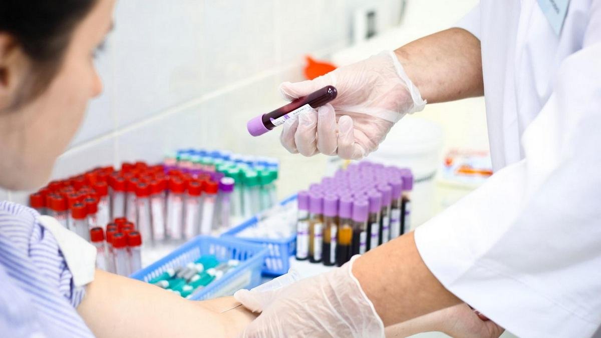 Где в Днепре бесплатно пройти тест на ВИЧ и гепатит С