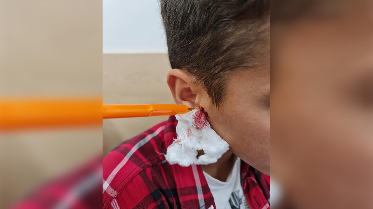 В Днепре 9-летнего школьника с вязальным крючком в ухе увезли в больницу