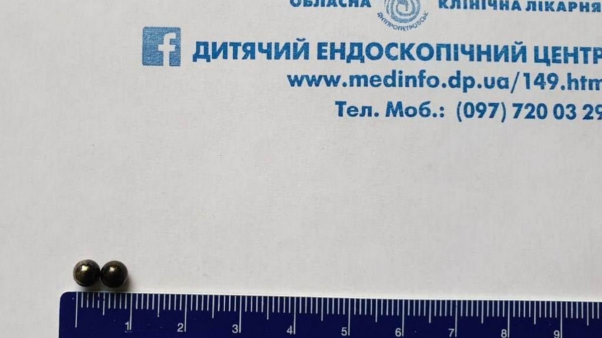 В областную детскую больницу в Днепре доставили 4-летнего ребенка, который проглотил магнитные шарики
