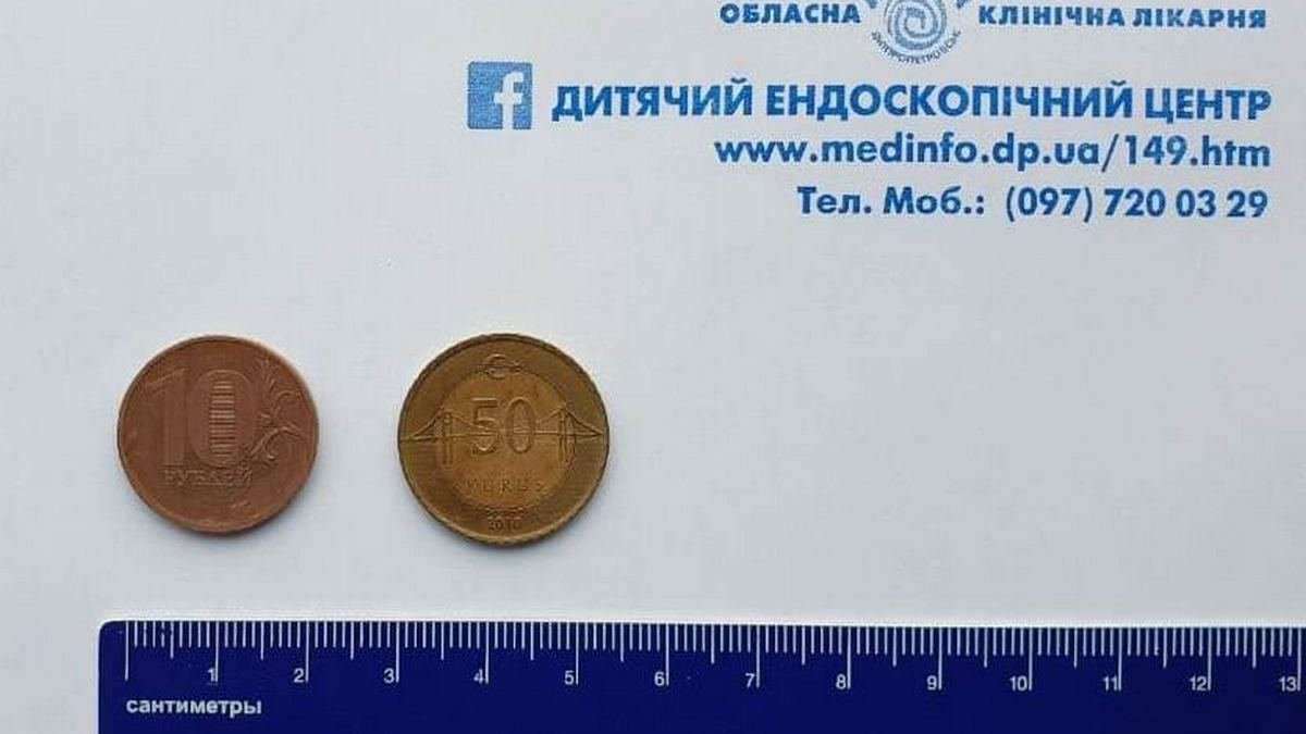 В Днепре 2-летний ребенок съел 10 рублей и 50 турецких курушей