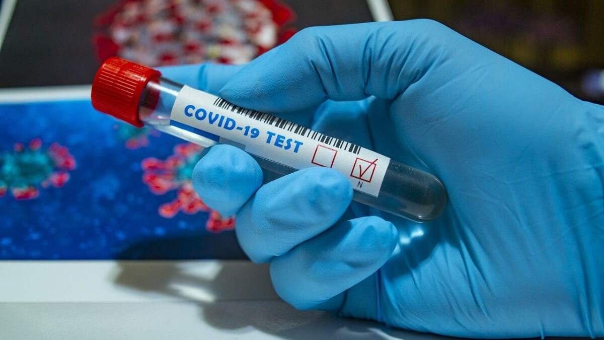 Коронавирус в Днепре и области: 1005 человек заболели за последние сутки