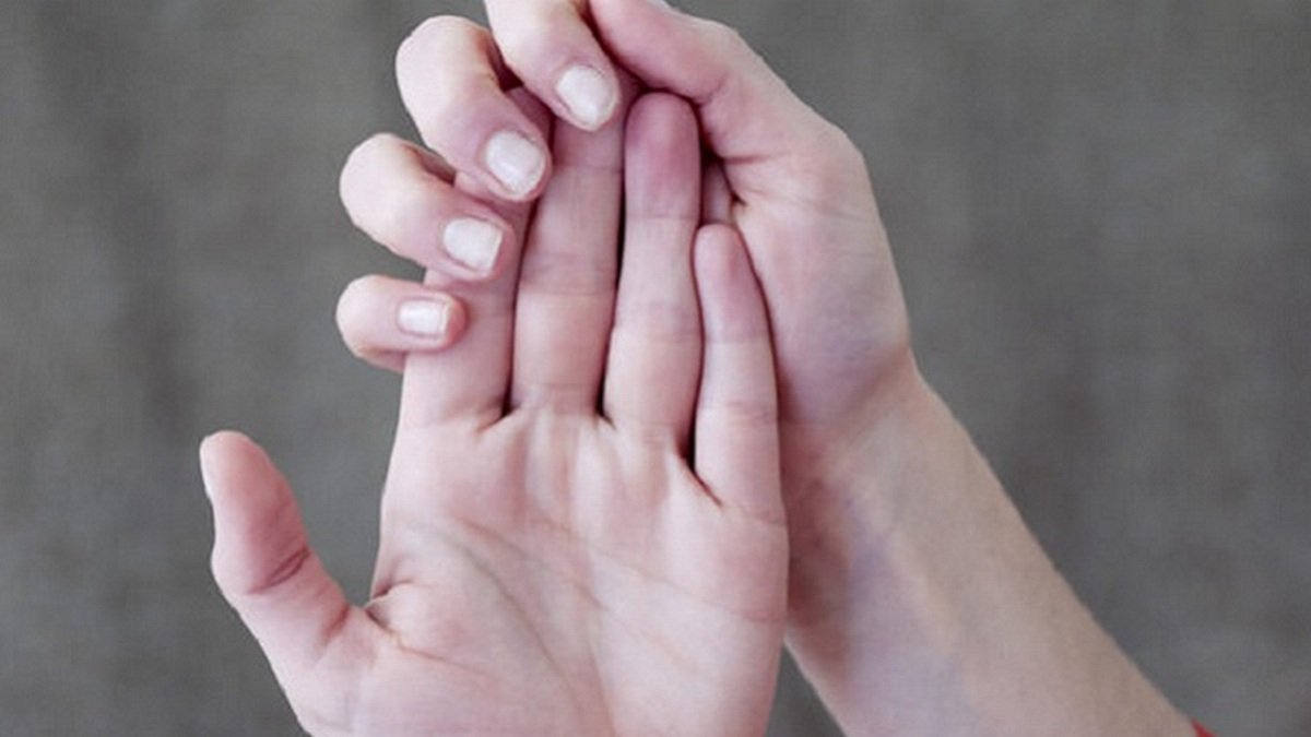В Днепре мужчина с некрозом пальцев готовится к операции: нужна помощь