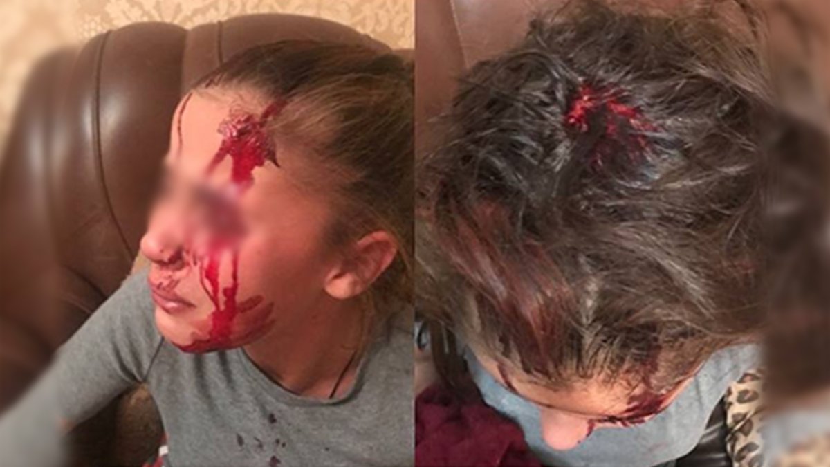 В Днепре на Рабкоровской во время семейной ссоры ударили 11-летнюю девочку и беременную женщину