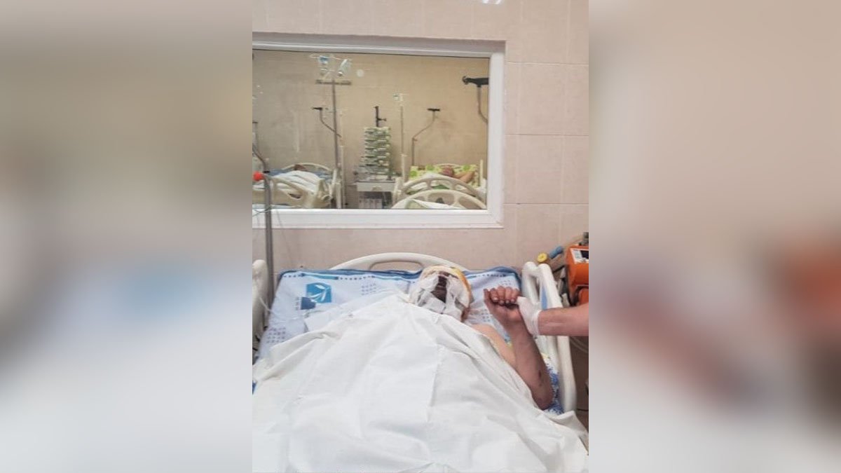 В Днепре в больнице Мечникова спасают мужчину с ожогами тела