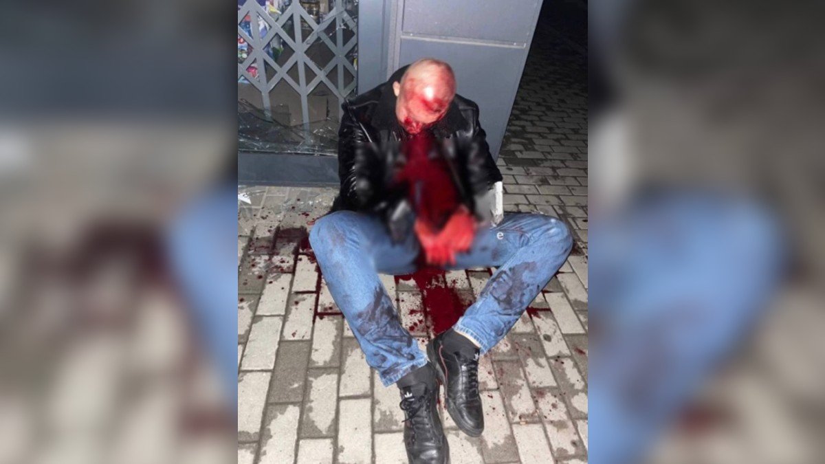 В Днепре на Образцова 27-летний пьяный мужчина лбом разбил витрину магазина