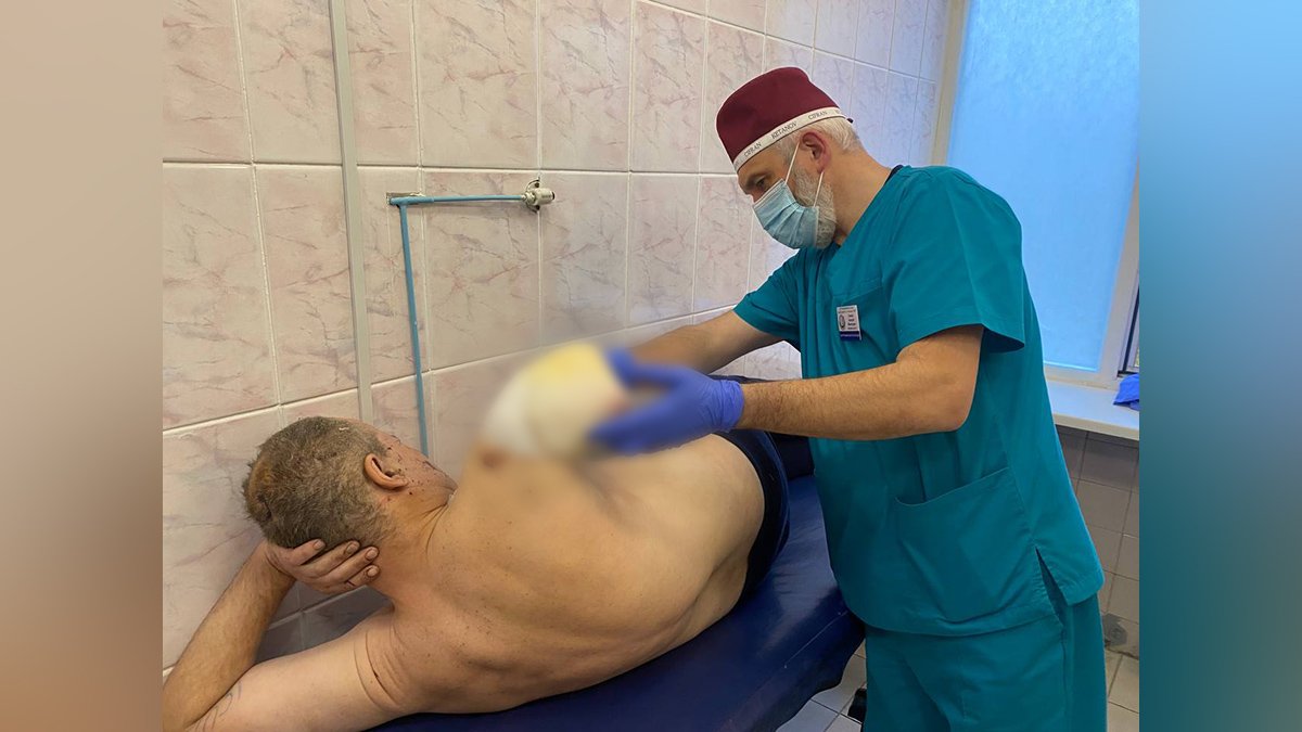 Осколок отрезал руку и покалечил ногу: в больнице Днепра спасают жизнь мужчины