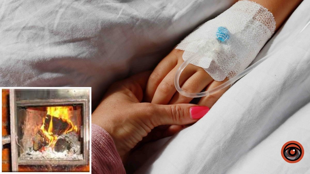 Получила ожоги, когда мать разжигала печку: в Днепре спасают 9-летнюю девочку