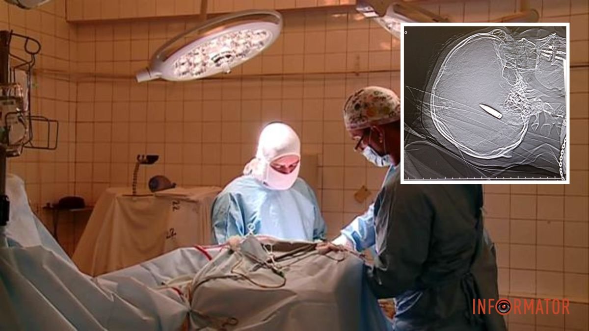 Пуля посреди мозга: в больнице Днепра спасают тяжелораненого 35-летнего мужчину