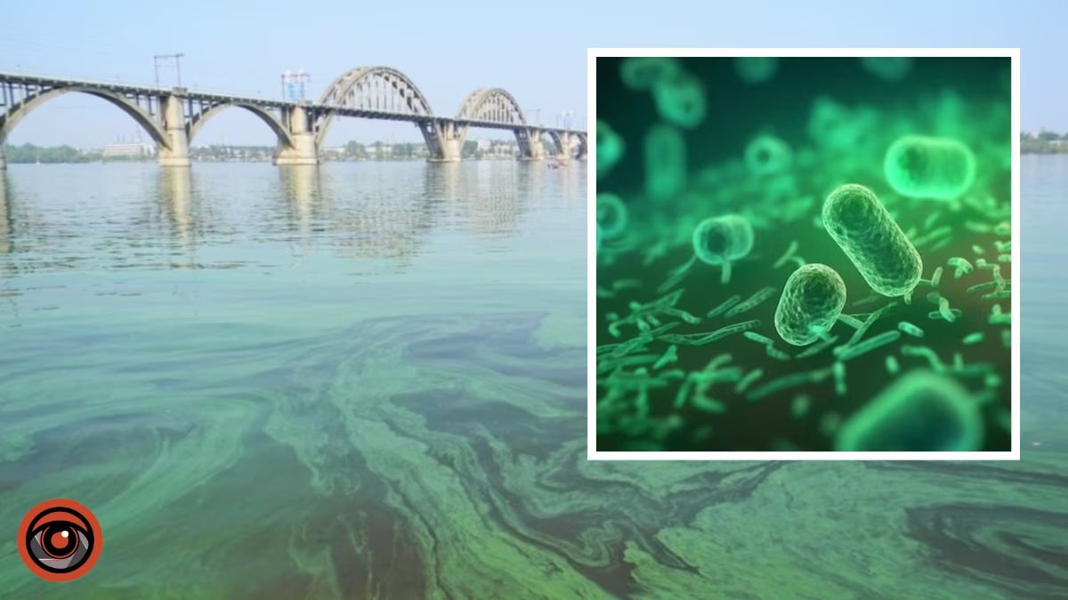 У водоймах Дніпра виявили холероподібний вібріон: де саме і чи є небезпека
