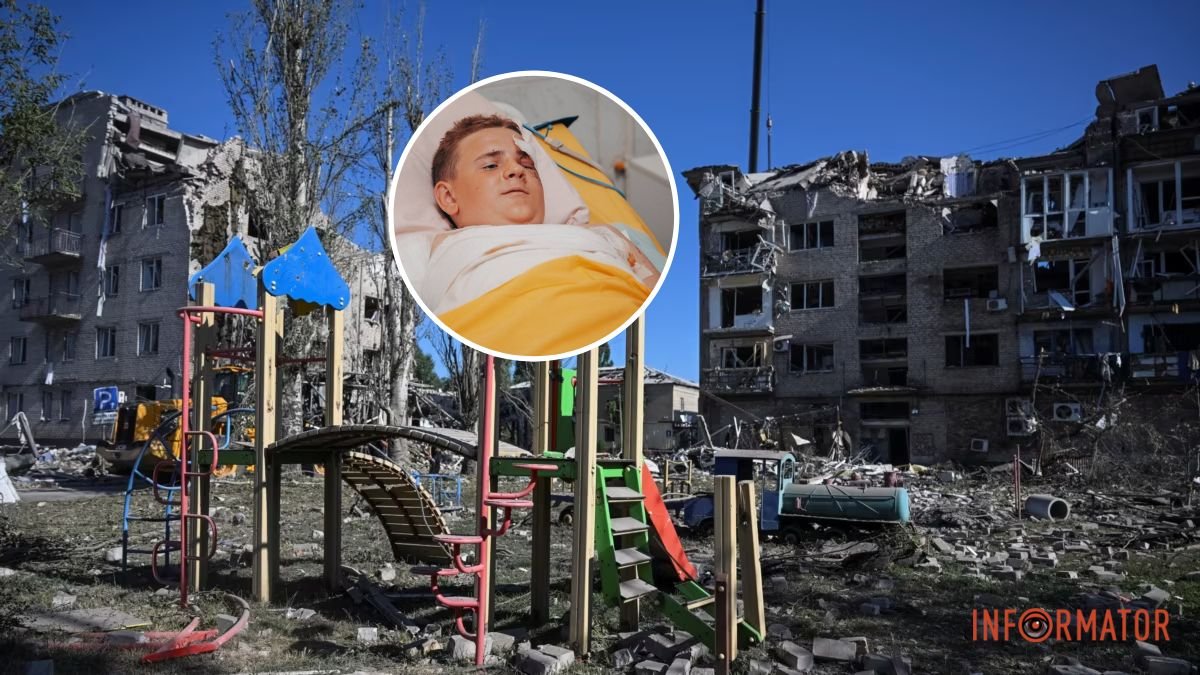 Дитину придавило плитами: у Дніпрі рятують 11-річного хлопчика, який постраждав під час ракетного обстрілу Покровська