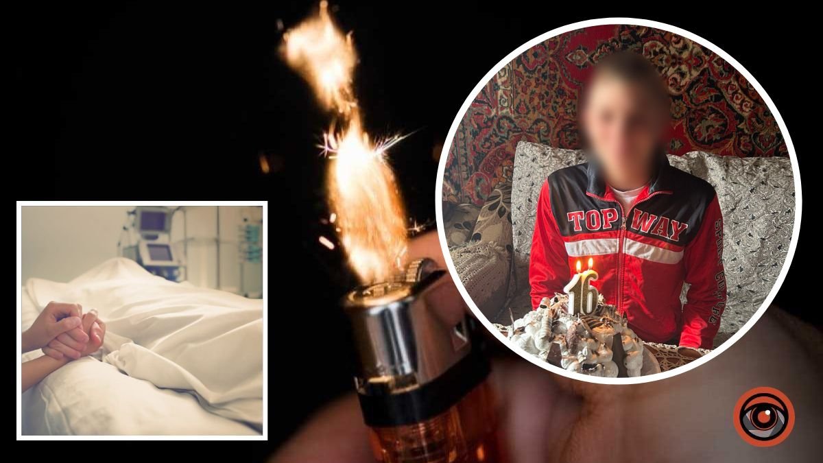 “Сусід запросив на чай”: стан хлопчика, якого підпалив пенсіонер у Дніпропетровській області