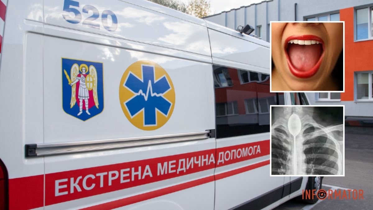 Опасный совет соседки: в Днепропетровской области женщина попала в больницу с разорванным языком