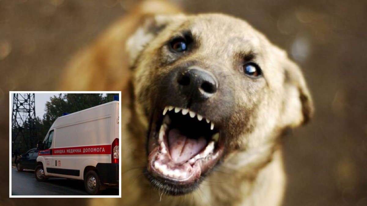 Артериальное кровотечение и геморрагический шок: в Днепре собака покусала женщину