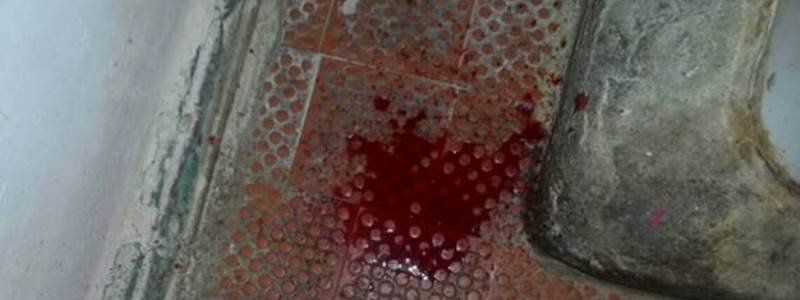 В Киеве пьяные мать и сын устроили кровавую разборку