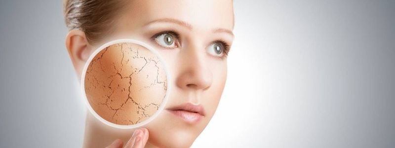 Як доглядати за шкірою взимку: поради косметолога