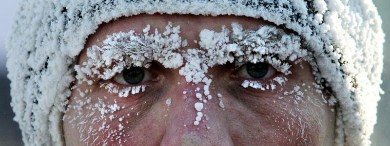 Чим небезпечна зима: правила поведінки на морозі та при обмороженнях