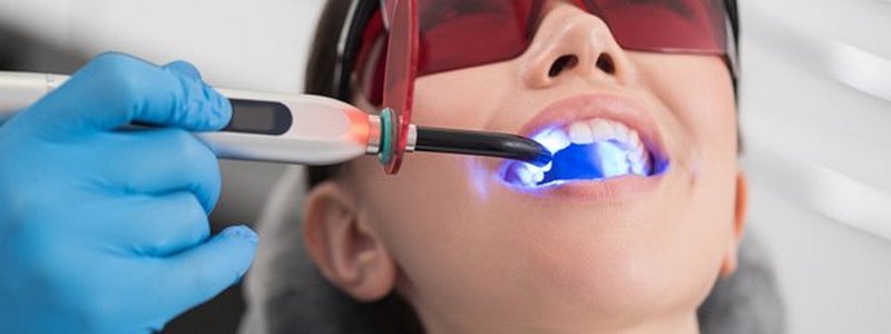 Отбеливание зубов: можно ли делать в салонах красоты и что нужно знать про процедуру