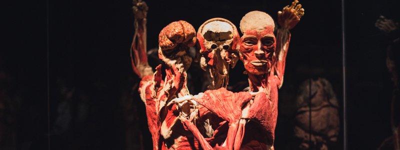 Тела и органы мертвых людей: чем удивит выставка BODY WORLDS на ВДНГ в Киеве