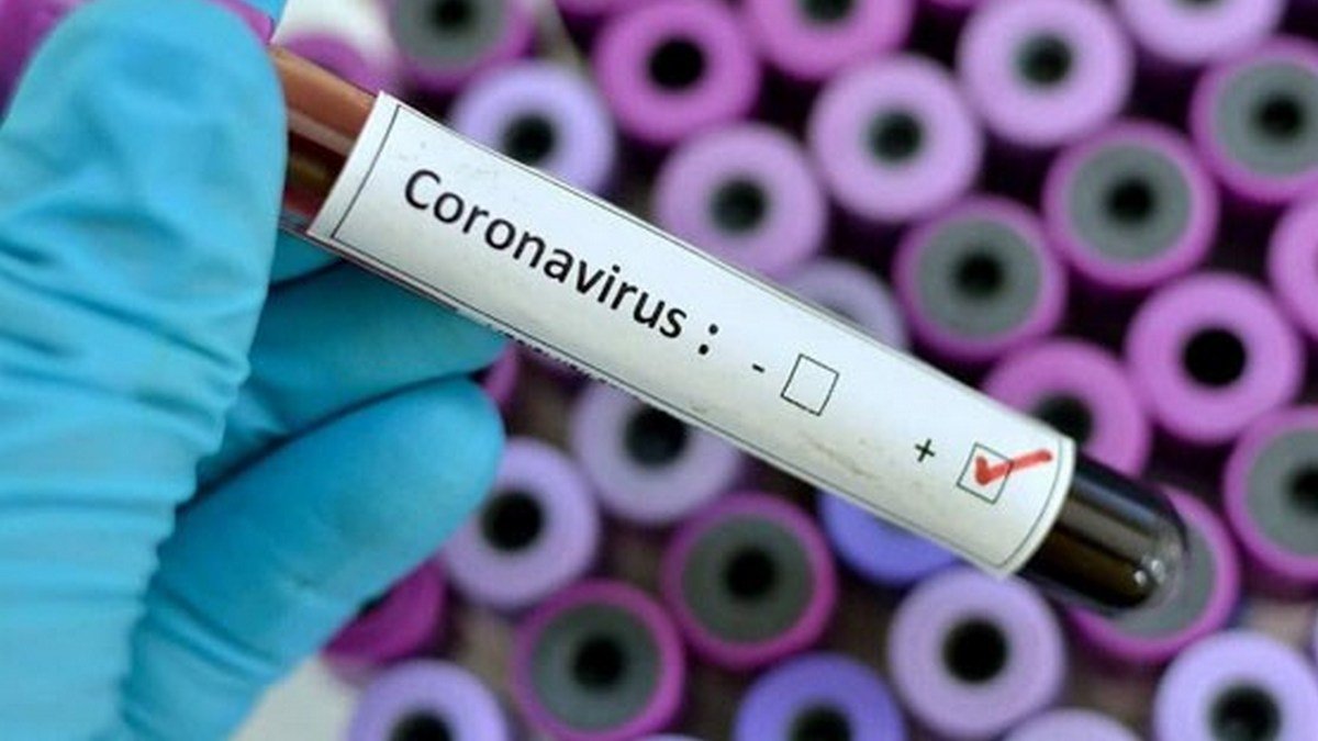 Украина получила тест-систему для определения смертельного коронавируса