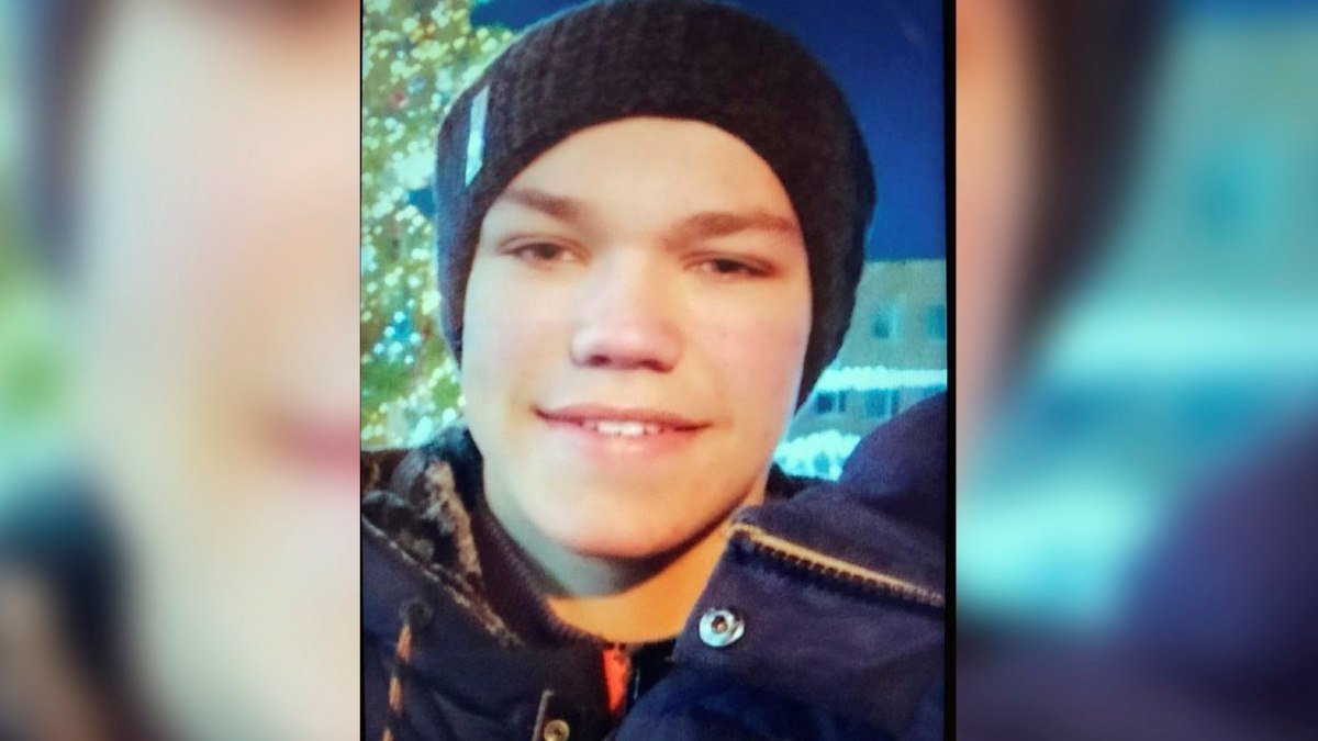 Под Киевом пропал 16-летний парень со шрамами на лице, который мог уехать в столицу
