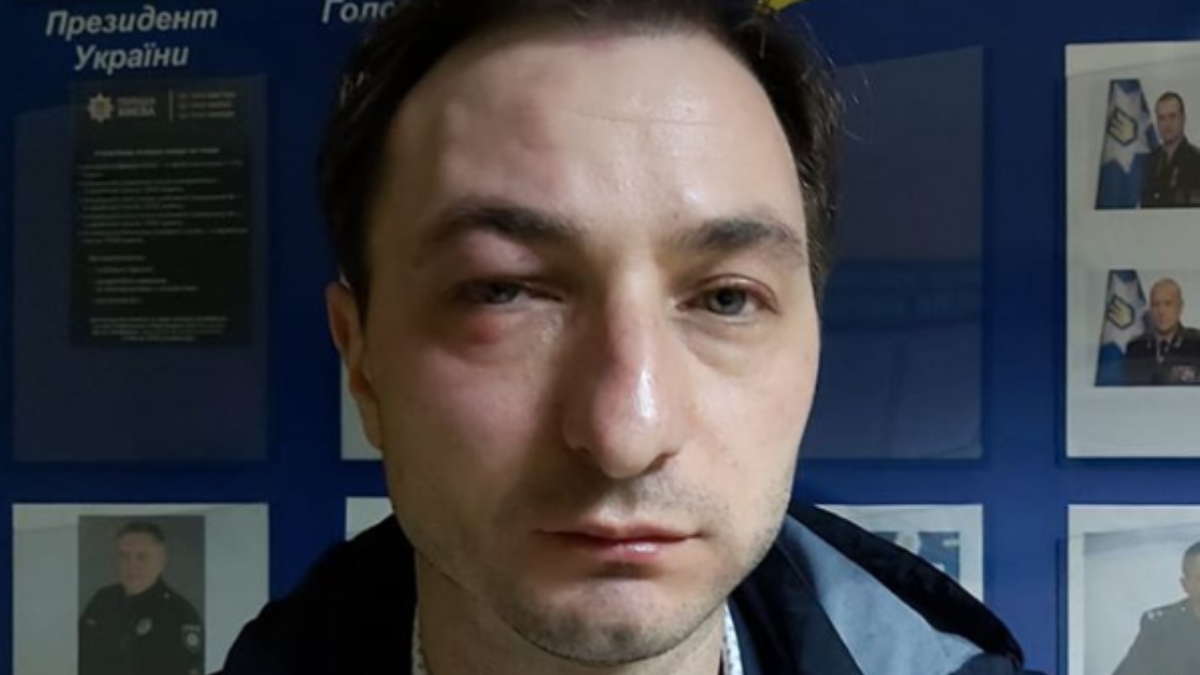 В Киеве напали на главного врача Национального института рака